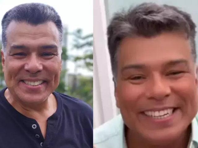 Aos 60 anos, Mauricio Mattar faz nova harmonização facial e mostra resultado